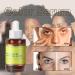 Dark Spot Remover Serum for Face & Body | Age Spot Sun Spot Freckles Brown Spot Corrector for Men & Women - 30ml - Buy Online on GoSupps.com