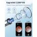 1296p Rechargeable Ear Wax Removal Tool Camera | Wireless Smart Otoscope for Earwax Remover | Visible Lighted Endoscope for Ear Cleaning - Buy Online on GoSupps.com