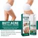  Uzionoie Butt Acne Cream Cream to Remove Acne on Buttocks Reduces Butt Pimples Restores Soft and Smooth Butt Skin 100ml - Buy Online on GoSupps.com
