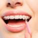 JMU Orthodontic Elastics 3/8 Inch Heavy 6.5oz 500 Pack - Latex Free Dental Rubber Bands Made in USA - Buy Online on GoSupps.com