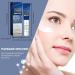 Mikabila 20g Dark Spot Age Spot Hyperpigmentation Corrector Skin Whitening Cream Anti Spot Moisturizing Face Cream Anti-Ageing Fine Lines Hyaluronic Acid Corrector Cream for Face and Body - Buy Online on GoSupps.com