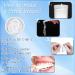 Brightening Dentures Prostheses - 4 PCs Snap-On Veneers for Men & Women | Cosmetic Fake Teeth Set - Buy Online on GoSupps.com