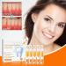 EXQST 2023 Gum Repair Ampoules Whitening Dental Disposable Serum Protect Gums Essence Gum Repair Essence Ampoules for Removing Tartar - Buy Online on GoSupps.com