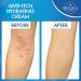 Soothing Relief Cream - Steroid-Free Anti-Itch Cream with Oat Extract for Itchy & Dry Skin - Next Gen U (8.5 oz) | International Shipping Available - Buy Online on GoSupps.com