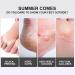 Foot Peel Mask For Hard Skin 2 Pairs Lavender Exfoliating Foot Mask Peel For Dead Skin Plant Formula Moisturising Brightening Socks Callus Remover Foot Mask Baby Soft Smooth Touch Feet - Buy Online on GoSupps.com