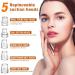 2023 Blackhead Remover Pore Vacuum - Upgraded Electric Facial Cleaner for Acne, Whiteheads - 5 Suction Power, 5 Probes - USB Rechargeable Kit for Women & Men - Buy Online on GoSupps.com