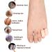 Hoogoo Pinky Toe Caps - 10 Pcs Silicone Small Toe Protector Cover Sleeves | Relief from Corns, Blisters, Sores | Reduce Friction & Rubbing - Buy Online on GoSupps.com