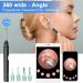 Ear Wax Removal Kit with 1080P HD Camera, 6 LED Lights, IP67 Waterproof - Wireless Ear Endoscope for iPhone, iPad & Android - Black - Buy Online on GoSupps.com