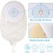 10 Pack 45mm One-Piece Urostomy Bags Anti-Leak Drainable Stoma Bags for Colostomy Ileostomy Stoma Care Anti-backflow Design Cut-to-Fit 10pcs urostomy bags - Buy Online on GoSupps.com