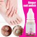 Nail Softener - Nail Strengthening Oil 10ml - Moisturizing Repair Care Nails Hands And Feet Sensitive Skin Men Women Daily Use Night Travel Manicure Pedicure - Buy Online on GoSupps.com