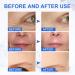 Buy Botox Stock Solution | Anti-Aging Facial Serum for Fine Lines & Wrinkles - International Shipping - Buy Online on GoSupps.com