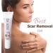 Boomers Scar Gel for Acne, Scars, and Sports Injuries - All Skin Types (15gm x 2) - Buy Online on GoSupps.com