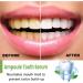 Buy Tlopa Ampoule Toothpaste Serum - Best Plaque Control for Healthy Teeth | International Shipping Available - Buy Online on GoSupps.com