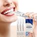 Teeth Whitening Pen, Teeth Whitening, 4 Pens for 70+ Uses, Use Twice a Day for Visibly Whiter Teeth in 1 Week, Effective Painless No Sensitivity Vanilla Mint Flavor