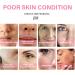 Glutathione Face Cream Glutathione Whitening Cream Facial Dark Spots Remover Face Moisturiser Anti-Aging Face Cream Face Cream for Sensitive Skin Anti Wrinkle Skin Tone Correcting - Buy Online on GoSupps.com