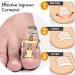 Ingrown Toenail Kit SKINAPEEL Toe Nail Softener and Ingrown Toenail Treatment Oil PLUS Ingrown Toenail Tool Correction Clamp & Double Ended Corrector Tool - Buy Online on GoSupps.com