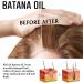 Batana Oil for Hair Growth Batana Oil Organic for Healthy Hair Deeply Nourishing Scalp Roll-On Hair Growth Essence Nourishes Thin Hair Scalp Skin and Loss Hair Growth Fir for All Hair Types - Buy Online on GoSupps.com