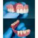 DIY Oral Care Kits | Customizable Full & Partial Sets for Complete Dental Care - Buy Online on GoSupps.com