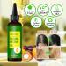 Batana Natural Hair Growth Oil - Organic Batana Oil for Stimulating Hair Growth Preventing Hair Loss & Eliminating Split Ends - 4FL OZ - Buy Online on GoSupps.com
