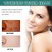 brown spots Sun Spots Lightening Face Cream | 30g Blemish Reducer Pigment Correcting Face Firming - Anti-Dark Spot Face Cream for Anloximt - Buy Online on GoSupps.com