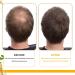 Hair Growth Spray Biotin Hair Growth Serum Hair Regrowth Spray Nourishes Hair & Scalp Hair Thickening Spray for Thicker Hair Anti-Hair Loss Hair Care Oil 30ML - Buy Online on GoSupps.com