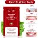 Professional Teeth Whitening Strips - 14 Treatments for Sensitive Teeth - Buy Online on GoSupps.com