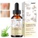 Cyperus Rotundus Oil for Hair Removal 100% Pure Natural Serum to Reduce Unwanted Hair Growth Moisturizes & Soothes Skin & Hair 2.02 Fl Oz