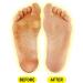 Callus Treatment Cream 4 oz - Podiatrist's Formula | Made in USA by Puritan's Pride | International Shipping Available - Buy Online on GoSupps.com