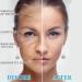 Buy Botox Facial Serum - Anti-Aging Vitamin C & Collagen Solution for Women | Reduce Fine Lines & Wrinkles | Nourish & Plump Skin - Buy Online on GoSupps.com