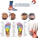 Magnetic Orthopedic Insoles for Men & Women | Acupressure Reflexology Insoles for Foot Health & Plantar Fasciitis Relief (Size 35-40 Men 4-7 | Women 6-9 - Buy Online on GoSupps.com