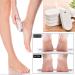 Pumice Stone Foot Scrubber Set - Callus Remover for Exfoliation | 4PCS Foot File for Feet, Hands & Body - Buy Online on GoSupps.com