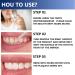 Ninnyi 2PCS Tooth Paint Enamel Instant Teeth Whitening Essence Gel for Stain Removal - Buy Online on GoSupps.com