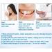 Tooth whitening essence tooth restoration and spot removal liquid professional tooth whitening liquid coffee tea stains and cola to clean yellow teeth (1 piece *10 cotton swabs) - Buy Online on GoSupps.com