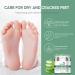 Urea 40% Foot Cream - Cracked Heel Repair Cream - Foot Cream for Cracked Heels and Dry Skin - Urea Cream for Feet with Tea Tree Oil Aloe Vera and Chamomile for Deep Moisturizing - Buy Online on GoSupps.com