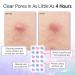 Grace & Stella Pimple Patches for Face - 72 Count Hydrocolloid Acne Zit Stickers - Vegan Dermatologist Tested Cruelty-Free Blemish Solutions - Buy Online on GoSupps.com