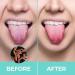 Premium Stainless Steel Tongue Cleaner Scraper - Green Oral Care Brush for Fresh Breath | Best Tongue Cleaning Tool - Buy Online on GoSupps.com