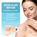 Buy Medical Grade Silicone Scar Sheets | Washable Scar Tape 1.6"x120" Roll - Ideal for Surgical Scars - Buy Online on GoSupps.com