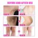 Go Ho 2PCS Dark Spot Remover - Vitamin C Cream for Face Body & More | Effective Blench Lotion & Dark Spots Corrector - Buy Online on GoSupps.com