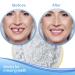False Tooth Repair Kit with Thermal Fitting Beads - Snap On Instant Smile - Denture Adhesive - Buy Online on GoSupps.com