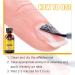 Fungal Nail Treatment For Toenails Extra Strong - Nail Fungus Treatment - Moisturize Cuticle Care Oils for Ingrown Toenails - Toenail Growth for Repairing Damaged & Discolored Nails(30ML) - Buy Online on GoSupps.com