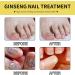 Tbeautfave Fungal Nail Treatment Nail Fungus Treatment for Toenail Ginseng Nail Treatment Essence Nail Growth Treatment Relief Oil Nail Repair Solution Toenail Oil Treatment Nail Care - Buy Online on GoSupps.com