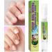 Nail Bite Prevention | Anti-Bite Nail Polish 4ml | Stop Thumb Sucking Cuticle Care for Adults and Children Boys and Girls - Buy Online on GoSupps.com