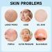 Face Masks Beauty - Sheet Mask - Face Masks Skincare for Women - Anti-Aging Face Masks - Hydrating Face Mask - Moisturizing & Nourishing Face Mask - Skin Care for Women - Face Care - Sheet Face Mask - Buy Online on GoSupps.com