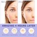 Mandabloom Acne Pimple Patches (210 Pack) with Tea Tree Oil & Salicylic Acid - Hydrocolloid Acne Dots for Face Zits & Breakouts - Buy Online on GoSupps.com