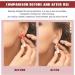 IOOOFU 100patches Invisible Ear Lift for Ear Lobe Support Tape Perfect for Stretched Ear Lobe Relieve Strain from Heavy Earring Plastic - Buy Online on GoSupps.com