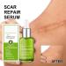 Goopgen Advanced Scar Repair Serum - Effective Scar Removal Spray for All Types of Scars - Buy Online on GoSupps.com