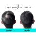  HAIR GO Premium Hair Thickening Shampoo - Hair Powder - Conditioner - For Hair Loss - 100% Natural and Vegan - 1 Pack (1 x 25g) (Dark Blonde) - Buy Online on GoSupps.com