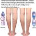 Bibykivn Medical Compression Stockings | Graded Support for Men & Women | Perfect for Varicose Veins Edema & Sports - Buy Online on GoSupps.com