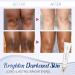 SnowySkin Legs Underarm Cream & Nose Strips Set - Instant Personal Skin Care | White | One Size - Buy Online on GoSupps.com