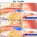 Ear Wax Removal Tool Kit - 30 Nozzles Manual Ear Irrigation Cleaner for Adults & Kids - Effective Ear Cleaning System (Blue - Buy Online on GoSupps.com